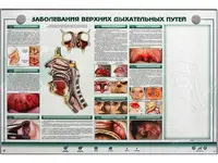 Интерактивный электрифицированный стенд "Заболевания верхних дыхательных путей" с натурными образцами Праймед