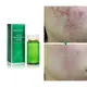 Тоник для лечения акне BREYLEE Acne Treatment Toner 100 мл очищающий поры